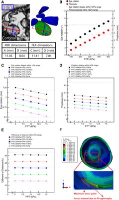 Identification of optimal surgical plan for treatment of extraocular muscle damage in thyroid eye disease patients based on computational biomechanics